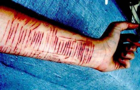 Đừng lo lắng về sự cố cắt tay, hãy xem hình ảnh để biết cách tránh nguy hiểm này và bảo vệ đôi tay của bạn.