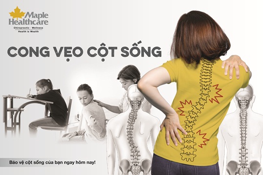 4 lý do không nên chủ quan với cong vẹo cột sống