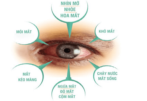 Các biểu hiện của mỏi mắt và cách nhận biết