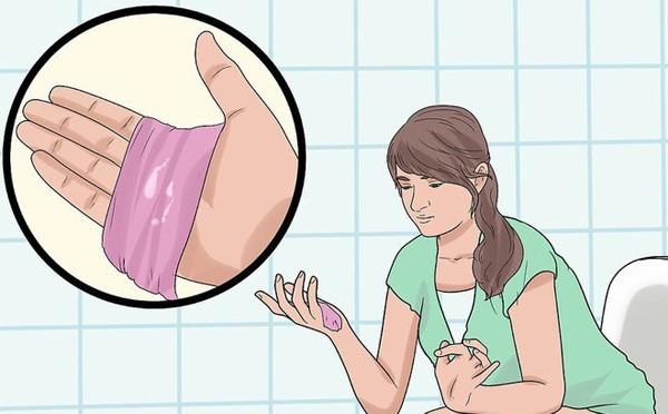 Cách đơn giản phòng ngừa các bệnh viêm âm đạo