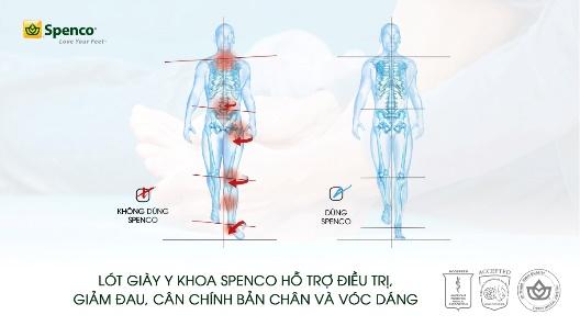 Lót giày y khoa là gì và có tốt không?- Ảnh 3.