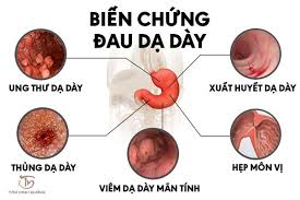 Triệu Chứng Của Bệnh Ung Thư Dạ Dày