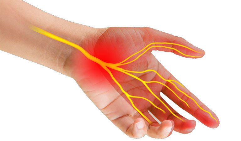 Hội chứng ống cổ tay là một tình trạng khá phổ biến và khiến bạn cảm thấy khó chịu, đau đớn trong quá trình sử dụng tay. Hãy xem hình ảnh liên quan để tìm hiểu những phương pháp điều trị và giúp bạn phục hồi sức khỏe tốt nhất.