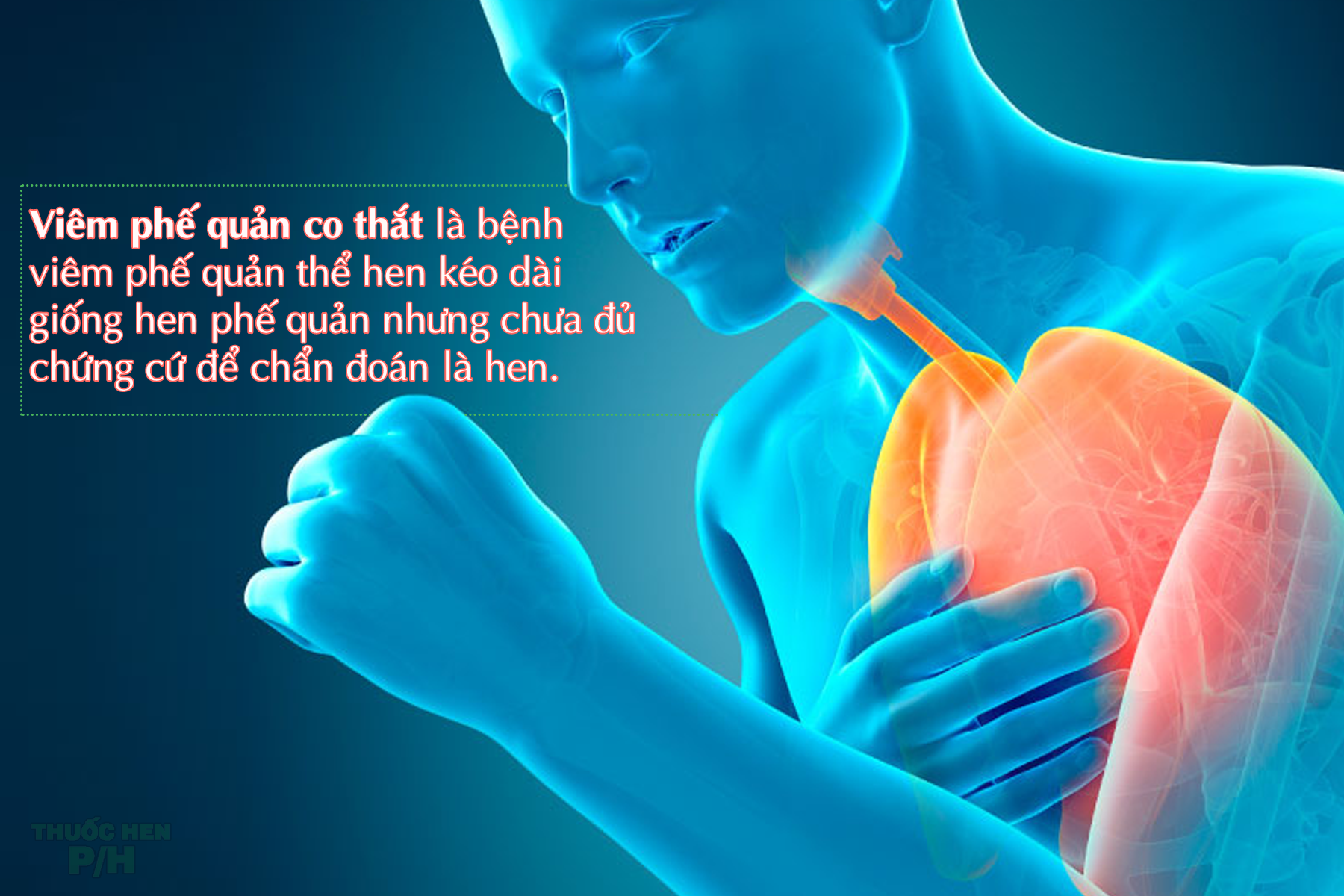 Viêm phế quản co thắt là gì? Nguyên nhân, triệu chứng, cách điều trị