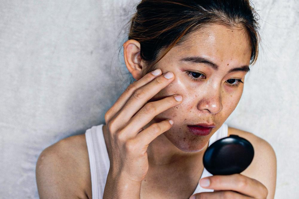 Nguyên nhân da vẫn sạm đen dù tránh nắng cẩn thận