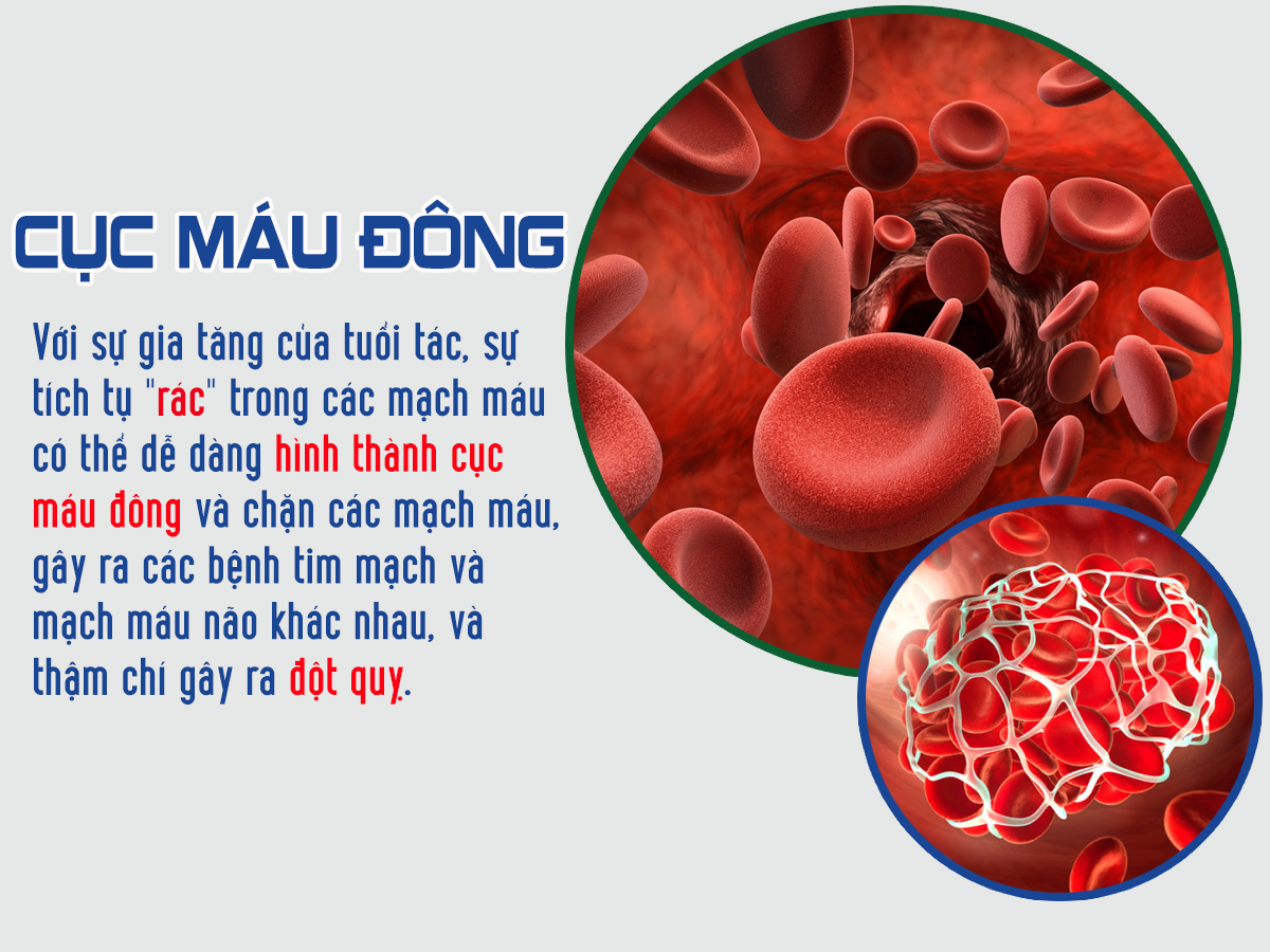 Mạch máu tắc - tuổi thọ ngắn: giải pháp hiệu quả để sống khỏe ...