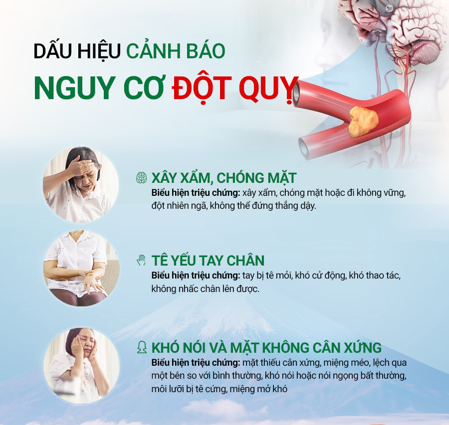 Triệu chứng cảnh báo đột quỵ