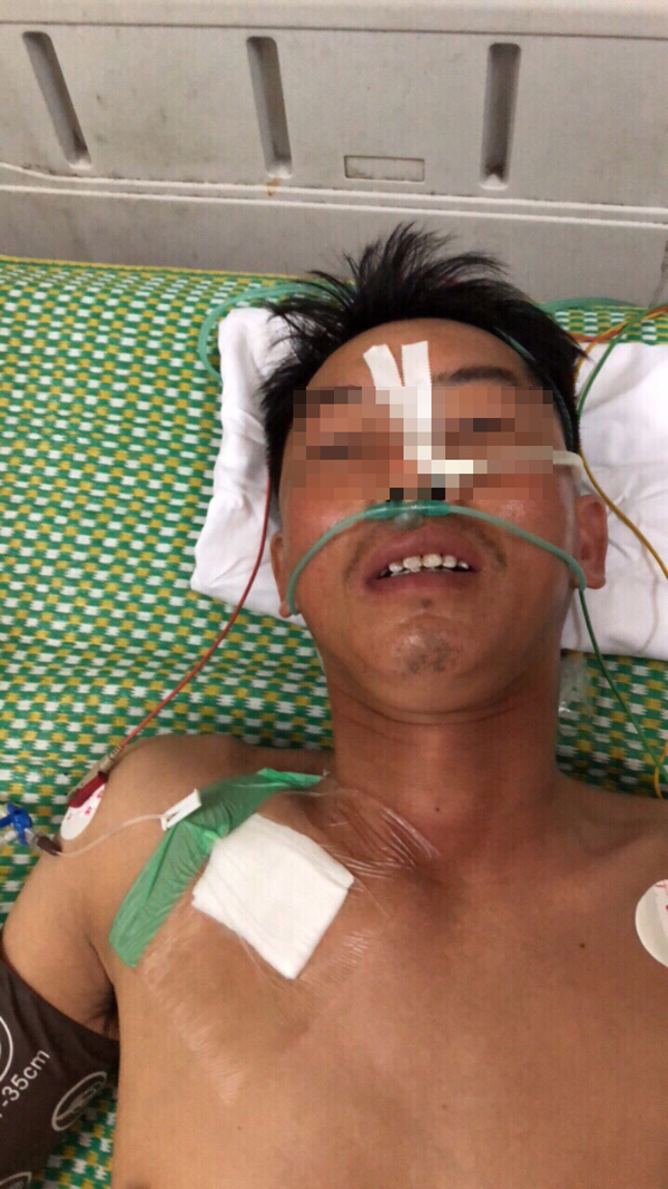 Cứu sống bệnh nhân bị thanh sắt chọc từ nếp bẹn xuyên ổ bụng