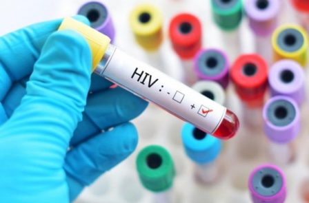 Xét nghiệm phát hiện đột biến kháng thuốc HIV