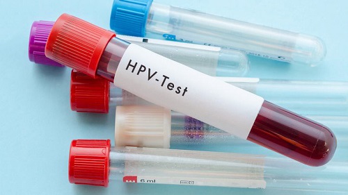 Khuyến nghị mới về xét nghiệm HPV để tầm soát ung thư cổ tử cung