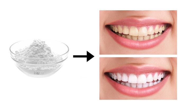 Gel Làm Trắng Răng: Cách Sử Dụng An Toàn