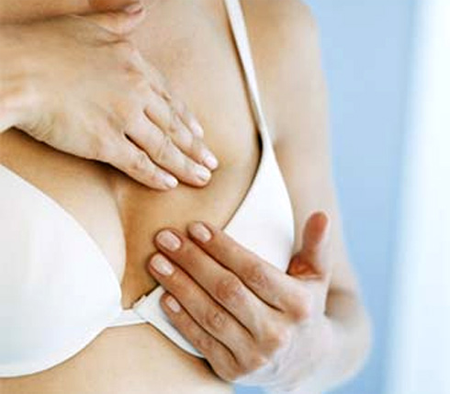 U sợi tuyến vú 2 U sợi tuyến vú 2