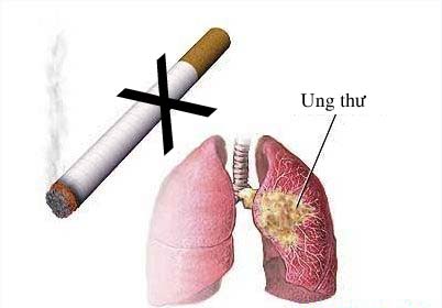 Các bệnh ung thư hay gặp do khói thuốc 1 Các bệnh ung thư hay gặp do khói thuốc 1