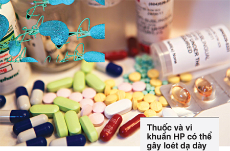 Bệnh dạ dày và cách phòng ngừa 1