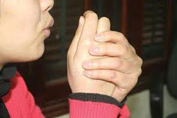 Thuốc Nam trị lạnh tay chân 1