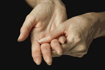 Viêm khớp dạng thấp - điều trị càng sớm, khả năng khỏi bệnh càng cao 1 Viêm khớp dạng thấp - điều trị càng sớm, khả năng khỏi bệnh càng cao 1