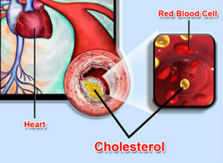 Thận trọng với thuốc hạ mỡ máu nhóm statin 1