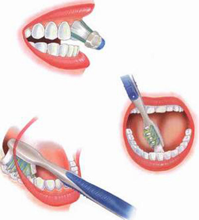 Co lợi, bất lợi cho răng 2 Co lợi, bất lợi cho răng 2