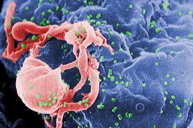 Một trẻ sơ sinh nhiễm HIV được chữa khỏi bệnh 2 Một trẻ sơ sinh nhiễm HIV được chữa khỏi bệnh 2