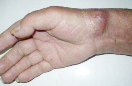 Hiểu đúng để tránh tai biến 1