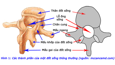 Nguy hiểm khi bị hẹp ống sống 1