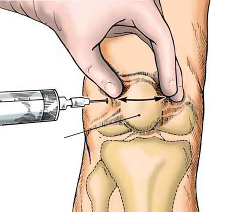 Hiểu đúng để tránh tai biến 2