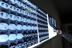 WHO cử chuyên gia sang Trung Quốc tìm hiểu về dịch cúm A/H7N9 2