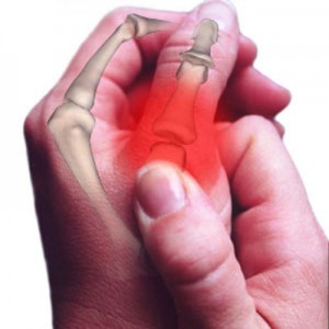 Biến chứng xương khớp ở bệnh nhân đái tháo đường 1