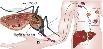 Nhận biết các thể bệnh sốt rét 1