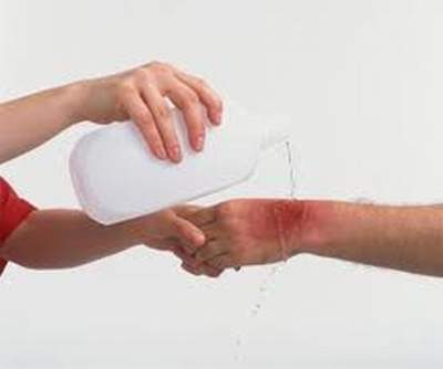 Xử trí sẩn ngứa do côn trùng 1 Xử trí sẩn ngứa do côn trùng 1