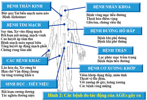 AGEs - gây nhiều bệnh và biến chứng nguy hại cho con người  2