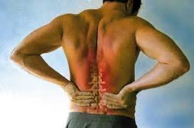 Chọn phương pháp nào để điều trị thoát vị đĩa đệm cột sống? 1