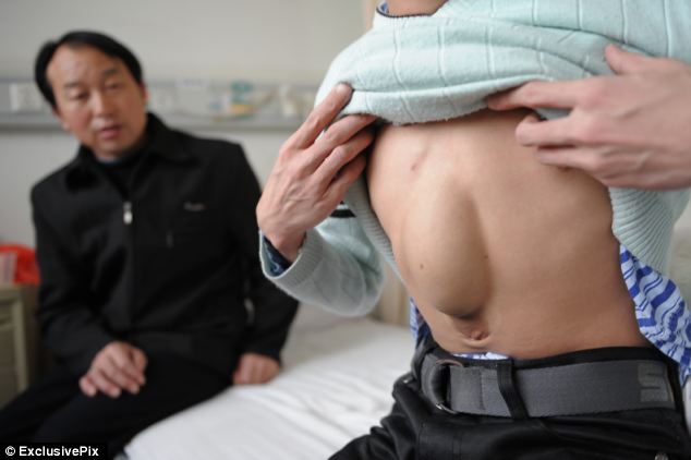 24 năm sống với trái tim trong... bụng 1