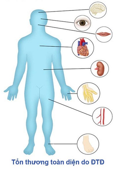 Thay đổi lối sống để phòng và trị đái tháo đường 1
