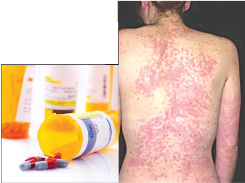 Những tác dụng ngược đáng lưu ý 1