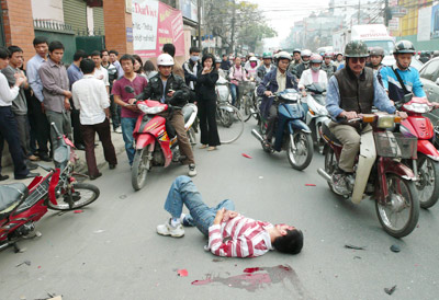 Hội chứng “không biết đau” 1