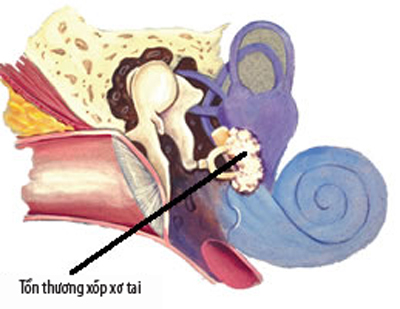 Các Biện Pháp Phòng Ngừa