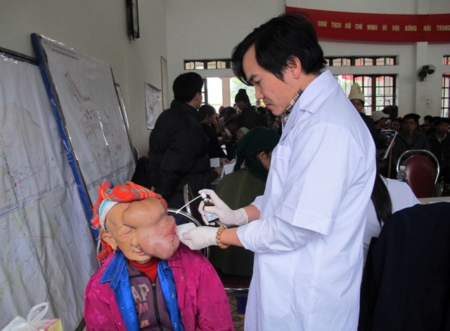 Cụ già 90 tuổi “đeo” khối u quái khổng lồ trên mặt 3