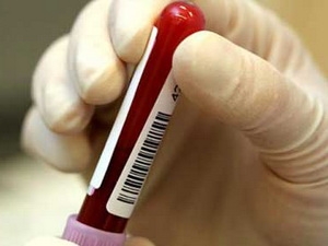 Đã có thể điều trị thành công trẻ sơ sinh nhiễm HIV 1