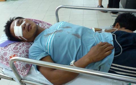 Bắn nhau kinh hoàng trên biển, nhiều người bị thương 2