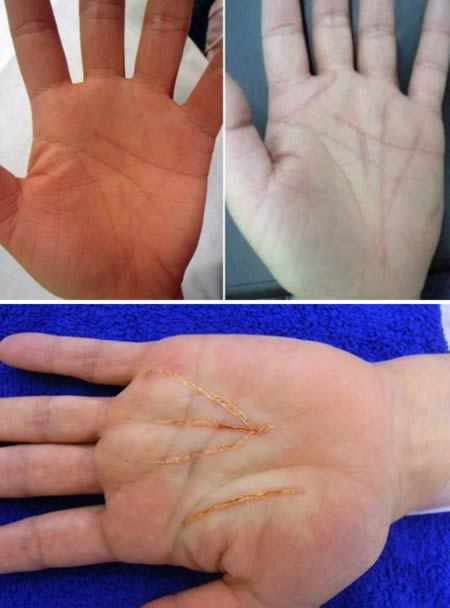 Những kiểu phẫu thuật thẩm mỹ lạ đời 1