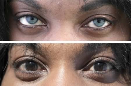 Những kiểu phẫu thuật thẩm mỹ lạ đời 2