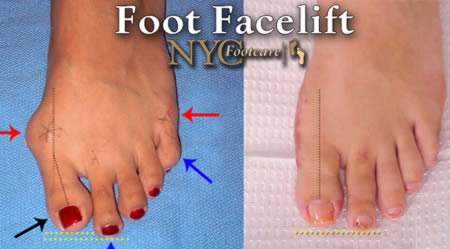 Những kiểu phẫu thuật thẩm mỹ lạ đời 3