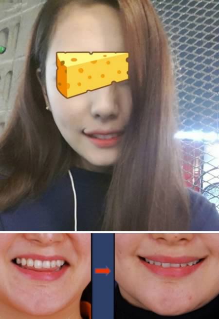 Những kiểu phẫu thuật thẩm mỹ lạ đời 6