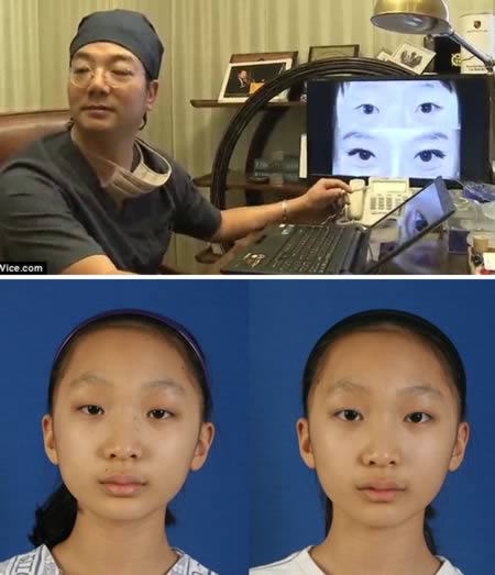 Những kiểu phẫu thuật thẩm mỹ lạ đời 7