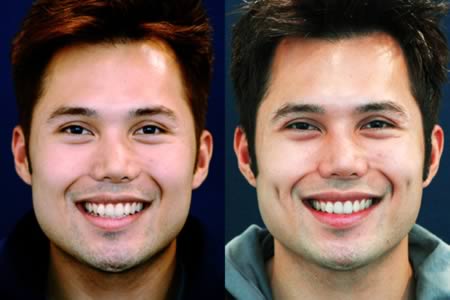 Những kiểu phẫu thuật thẩm mỹ lạ đời 8