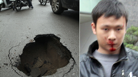 Hà Nội: Một người nhập viện vì “hố tử thần” 1 Hà Nội: Một người nhập viện vì “hố tử thần” 1
