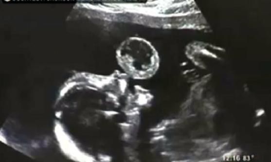 Thành tựu y tế thế giới nổi bật 2012 4