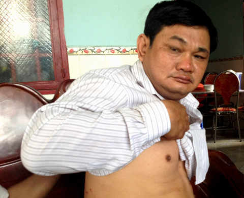 Nổ súng khống chế kẻ bắt cóc đòi chuộc 3 tỷ đồng  1