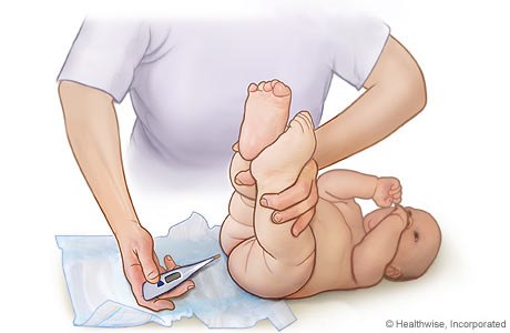 Khi nào cần đưa bé đến bác sĩ 1